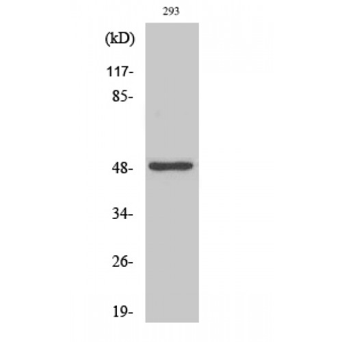 NEUROD2 Antibody - Western blot of Neuro D2 antibody
