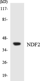 NEUROD2 Antibody - Western blot analysis of the lysates from COLO205 cells using NDF2 antibody.