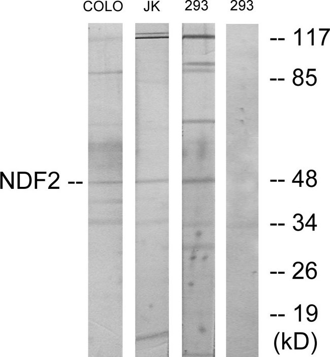 NEUROD2 Antibody - Western blot analysis of lysates from 293, COLO, and Jurkat cells, using NDF2 Antibody. The lane on the right is blocked with the synthesized peptide.