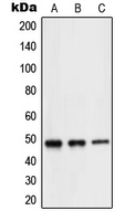 NEUROD2 Antibody - Western blot analysis of NEUROD2 expression in Jurkat (A); mouse brain (B); rat brain (C) whole cell lysates.