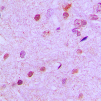 NEUROD2 Antibody - Immunohistochemical analysis of NEUROD2 staining in human brain formalin fixed paraffin embedded tissue section. The section was pre-treated using heat mediated antigen retrieval with sodium citrate buffer (pH 6.0). The section was then incubated with the antibody at room temperature and detected using an HRP conjugated compact polymer system. DAB was used as the chromogen. The section was then counterstained with hematoxylin and mounted with DPX.