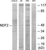 NEUROD2 Antibody - Western blot analysis of extracts from COLO cells, Jurkat cells and 293 cells, using NDF2 antibody.