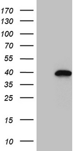 NEUROD4 Antibody - HEK293T cells were transfected with the pCMV6-ENTRY control. (Left lane) or pCMV6-ENTRY NEUROD4. (Right lane) cDNA for 48 hrs and lysed. Equivalent amounts of cell lysates. (5 ug per lane) were separated by SDS-PAGE and immunoblotted with anti-NEUROD4. (1:2000)