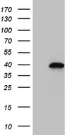NEUROD4 Antibody - HEK293T cells were transfected with the pCMV6-ENTRY control. (Left lane) or pCMV6-ENTRY NEUROD4. (Right lane) cDNA for 48 hrs and lysed. Equivalent amounts of cell lysates. (5 ug per lane) were separated by SDS-PAGE and immunoblotted with anti-NEUROD4. (1:2000)