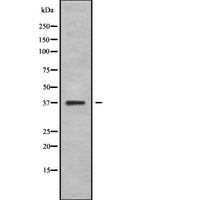NEUROD4 Antibody - Western blot analysis NEUROD4 using COLO205 whole cells lysates