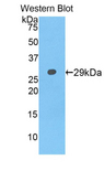 Neurofascin / NF Antibody - Western blot of recombinant Neurofascin / NF.  This image was taken for the unconjugated form of this product. Other forms have not been tested.
