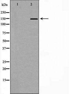 Neurofascin / NF Antibody - Western blot analysis of extracts of A549 cell lysate using NFASC antibody. The lane on the left is treated with the antigen-specific peptide.
