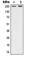Neurofibromin / NF1 Antibody - Western blot analysis of NF1 expression in A431 (A); HeLa (B) whole cell lysates.
