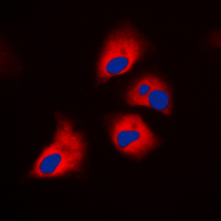 Neurofibromin / NF1 Antibody - Immunofluorescent analysis of NF1 staining in HeLa cells. Formalin-fixed cells were permeabilized with 0.1% Triton X-100 in TBS for 5-10 minutes and blocked with 3% BSA-PBS for 30 minutes at room temperature. Cells were probed with the primary antibody in 3% BSA-PBS and incubated overnight at 4 C in a humidified chamber. Cells were washed with PBST and incubated with a DyLight 594-conjugated secondary antibody (red) in PBS at room temperature in the dark. DAPI was used to stain the cell nuclei (blue).
