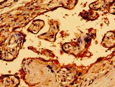 Neurofibromin / NF1 Antibody - Immunohistochemistry image of paraffin-embedded human placenta tissue at a dilution of 1:100