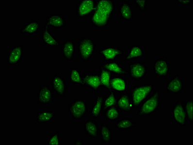 Neurofibromin / NF1 Antibody - Immunofluorescence staining of A549 cells with NF1 Antibody at 1:100, counter-stained with DAPI. The cells were fixed in 4% formaldehyde, permeabilized using 0.2% Triton X-100 and blocked in 10% normal Goat Serum. The cells were then incubated with the antibody overnight at 4°C. The secondary antibody was Alexa Fluor 488-congugated AffiniPure Goat Anti-Rabbit IgG(H+L).