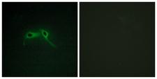 Neurofibromin / NF1 Antibody - Peptide - + Immunofluorescence analysis of HepG2 cells, using NF1 antibody.