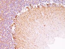 Neurofilament Antibody - Formalin-fixed, paraffin-embedded human cerebellum stained with Neurofilament antibody (NR-4).  This image was taken for the unmodified form of this product. Other forms have not been tested.