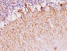 Neurofilament Antibody - Formalin-fixed, paraffin-embedded human cerebellum stained with Neurofilament antibody (SPM145).  This image was taken for the unmodified form of this product. Other forms have not been tested.