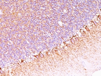 Neurofilament Antibody - Formalin-fixed, paraffin-embedded human cerebellum stained with anti-Neurofilament antibody (SPM563).  This image was taken for the unmodified form of this product. Other forms have not been tested.