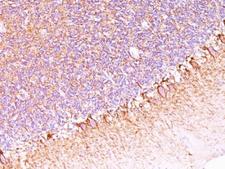 Neurofilament Antibody - Formalin-fixed, paraffin-embedded human cerebellum stained with anti-Neurofilament antibody (SPM563).  This image was taken for the unmodified form of this product. Other forms have not been tested.