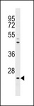 NEUROG1 / NGN1 / Neurogenin 1 Antibody - The anti-NeuroG1 N-term antibody is used in Western blot to detect NeuroG1 in A375 cell lysate.