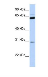 NEUROG1 / NGN1 / Neurogenin 1 Antibody - Placenta lysate. Antibody concentration: 1.0 ug/ml. Gel concentration: 12%.  This image was taken for the unconjugated form of this product. Other forms have not been tested.