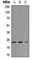 NEUROG1 / NGN1 / Neurogenin 1 Antibody - Western blot analysis of Neurogenin 1 expression in MCF7 (A); Raw264.7 (B); H9C2 (C) whole cell lysates.