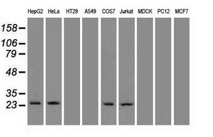 NEUROG1 / NGN1 / Neurogenin 1 Antibody - Western blot of extracts (35 ug) from 9 different cell lines by using anti-NEUROG1 monoclonal antibody.
