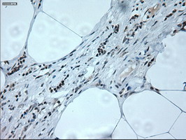 NEUROG1 / NGN1 / Neurogenin 1 Antibody - IHC of paraffin-embedded lymph node tissue using anti-NEUROG1 mouse monoclonal antibody. (Dilution 1:50).