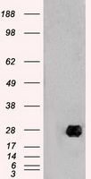 NEUROG1 / NGN1 / Neurogenin 1 Antibody - HEK293T cells were transfected with the pCMV6-ENTRY control (Left lane) or pCMV6-ENTRY NEUROG1 (Right lane) cDNA for 48 hrs and lysed. Equivalent amounts of cell lysates (5 ug per lane) were separated by SDS-PAGE and immunoblotted with anti-NEUROG1.