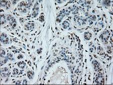 NEUROG1 / NGN1 / Neurogenin 1 Antibody - Immunohistochemical staining of paraffin-embedded breast tissue using anti-NEUROG1 mouse monoclonal antibody. (Dilution 1:50).