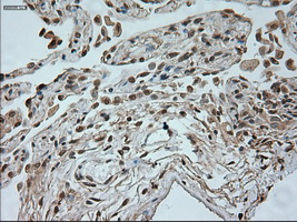 NEUROG1 / NGN1 / Neurogenin 1 Antibody - Immunohistochemical staining of paraffin-embedded lung tissue using anti-NEUROG1 mouse monoclonal antibody. (Dilution 1:50).