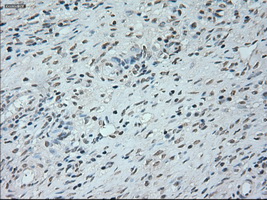 NEUROG1 / NGN1 / Neurogenin 1 Antibody - Immunohistochemical staining of paraffin-embedded Ovary tissue using anti-NEUROG1 mouse monoclonal antibody. (Dilution 1:50).