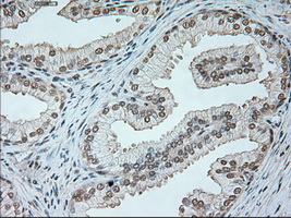NEUROG1 / NGN1 / Neurogenin 1 Antibody - Immunohistochemical staining of paraffin-embedded prostate tissue using anti-NEUROG1 mouse monoclonal antibody. (Dilution 1:50).
