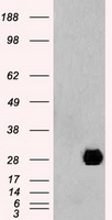 NEUROG1 / NGN1 / Neurogenin 1 Antibody - HEK293T cells were transfected with the pCMV6-ENTRY control (Left lane) or pCMV6-ENTRY NEUROG1 (Right lane) cDNA for 48 hrs and lysed. Equivalent amounts of cell lysates (5 ug per lane) were separated by SDS-PAGE and immunoblotted with anti-NEUROG1.