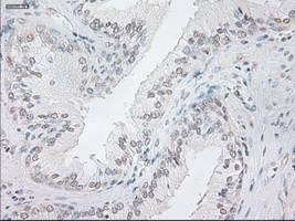 NEUROG1 / NGN1 / Neurogenin 1 Antibody - IHC of paraffin-embedded prostate tissue using anti-NEUROG1 mouse monoclonal antibody. (Dilution 1:50).