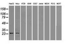 NEUROG1 / NGN1 / Neurogenin 1 Antibody - IHC of paraffin-embedded breast tissue using anti-NEUROG1 mouse monoclonal antibody. (Dilution 1:50).