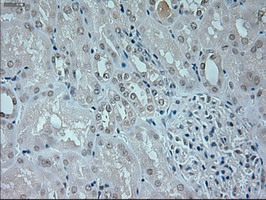 NEUROG1 / NGN1 / Neurogenin 1 Antibody - IHC of paraffin-embedded lung tissue using anti-NEUROG1 mouse monoclonal antibody. (Dilution 1:50).