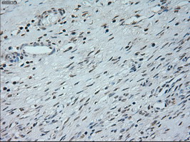 NEUROG1 / NGN1 / Neurogenin 1 Antibody - IHC of paraffin-embedded prostate tissue using anti-NEUROG1 mouse monoclonal antibody. (Dilution 1:50).