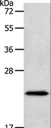 NEUROG1 / NGN1 / Neurogenin 1 Antibody - Western blot analysis of Human liver cancer tissue, using NEUROG1 Polyclonal Antibody at dilution of 1:400.
