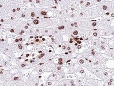 NEUROG1 / NGN1 / Neurogenin 1 Antibody - 1:100 staining human liver tissue by IHC-P. The tissue was formaldehyde fixed and a heat mediated antigen retrieval step in citrate buffer was performed. The tissue was then blocked and incubated with the antibody for 1.5 hours at 22°C. An HRP conjugated goat anti-rabbit antibody was used as the secondary.