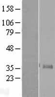 NEUROG1 / NGN1 / Neurogenin 1 Protein - Western validation with an anti-DDK antibody * L: Control HEK293 lysate R: Over-expression lysate