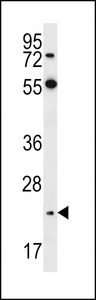 NEUROG2 / NGN2 / Neurogenin 2 Antibody - Neurogenin2 Antibody (D235) western blot of HeLa cell line lysates (35 ug/lane). The Neurogenin2 antibody detected the Neurogenin2 protein (arrow).