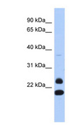 NEUROG2 / NGN2 / Neurogenin 2 Antibody - NEUROG2 / NGN2 antibody Western blot of Fetal Thymus lysate. This image was taken for the unconjugated form of this product. Other forms have not been tested.