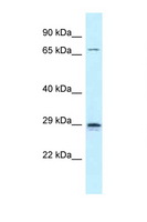 NEUROG2 / NGN2 / Neurogenin 2 Antibody - NEUROG2 / NGN2 antibody Western blot of Small Intestine lysate. Antibody concentration 1 ug/ml.  This image was taken for the unconjugated form of this product. Other forms have not been tested.