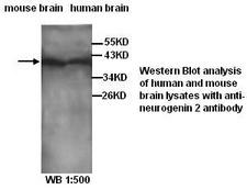 NEUROG2 / NGN2 / Neurogenin 2 Antibody