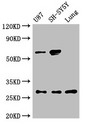 NEUROG2 / NGN2 / Neurogenin 2 Antibody - Positive WB detected in:U87 whole cell lysate,SH-SY5Y whole cell lysate,Rat lung tissue;All lanes:NEUROG2 antibody at 3?g/ml;Secondary;Goat polyclonal to rabbit IgG at 1/50000 dilution;Predicted band size: 29 KDa;Observed band size: 29,60 KDa;