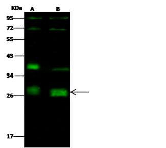 NEUROG2 / NGN2 / Neurogenin 2 Antibody - Anti-NEUROG2 rabbit polyclonal antibody at 1:500 dilution. Lane A: HepG2 Whole Cell Lysate. Lane B: SH-SY5Y Whole Cell Lysate. Lysates/proteins at 30 ug per lane. Secondary: Goat Anti-Rabbit IgG H&L (Dylight 800) at 1/10000 dilution. Developed using the Odyssey technique. Performed under reducing conditions. Predicted band size: 29 kDa. Observed band size: 29 kDa. (We are unsure as to the identity of these extra bands.)