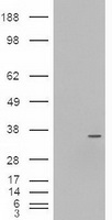 NEUROG3 / NGN3 / Neurogenin 3 Antibody - HEK293T cells were transfected with the pCMV6-ENTRY control (Left lane) or pCMV6-ENTRY NEUROG3 (Right lane) cDNA for 48 hrs and lysed. Equivalent amounts of cell lysates (5 ug per lane) were separated by SDS-PAGE and immunoblotted with anti-NEUROG3.