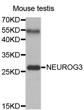 NEUROG3 / NGN3 / Neurogenin 3 Antibody - Western blot analysis of extracts of mouse testis tissue, using NEUROG3 antibody.