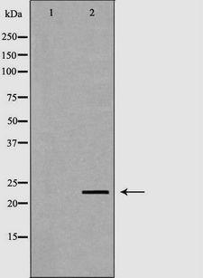 NEUROG3 / NGN3 / Neurogenin 3 Antibody - Western blot analysis of extracts of mouse liver tissue lysate using NEUROG3 antibody. The lane on the left is treated with the antigen-specific peptide.