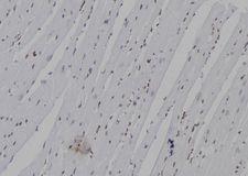 NEUROG3 / NGN3 / Neurogenin 3 Antibody - 1:100 staining mouse heart tissue by IHC-P. The sample was formaldehyde fixed and a heat mediated antigen retrieval step in citrate buffer was performed. The sample was then blocked and incubated with the antibody for 1.5 hours at 22°C. An HRP conjugated goat anti-rabbit antibody was used as the secondary.