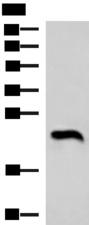 NEUROG3 / NGN3 / Neurogenin 3 Antibody - Western blot analysis of Human heart tissue lysate  using NEUROG3 Polyclonal Antibody at dilution of 1:1000