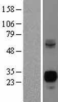 NEUROG3 / NGN3 / Neurogenin 3 Protein - Western validation with an anti-DDK antibody * L: Control HEK293 lysate R: Over-expression lysate